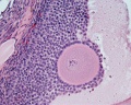 Secondary follicle, cumulus oophorus, zona pelucida, granulosa cells, oocyte x20