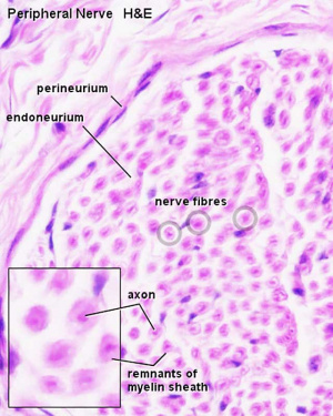 Peripheral nerve histology 01.jpg