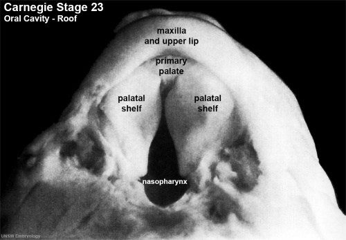 Stage23 embryo oral cavity 04.jpg
