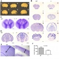 Absence of CSFR1 Impacts Normal Development of Brain Architecture.jpg