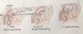 Surgeries on the reproductive system in men Z3463667 Student-drawn image relevant to project. Includes source information and student template. Well designed figure explaining male terminology.