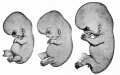 Fig. 93. Human embryo of 23 mm (2 months).