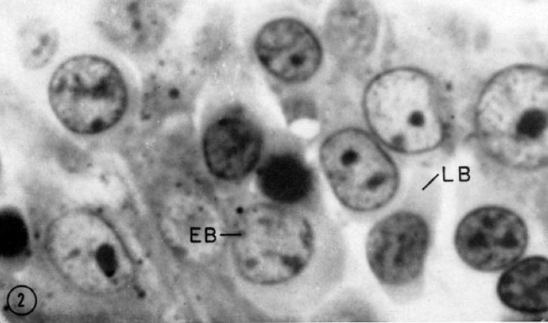 File:Fetal liver erythroblasts 01.jpg