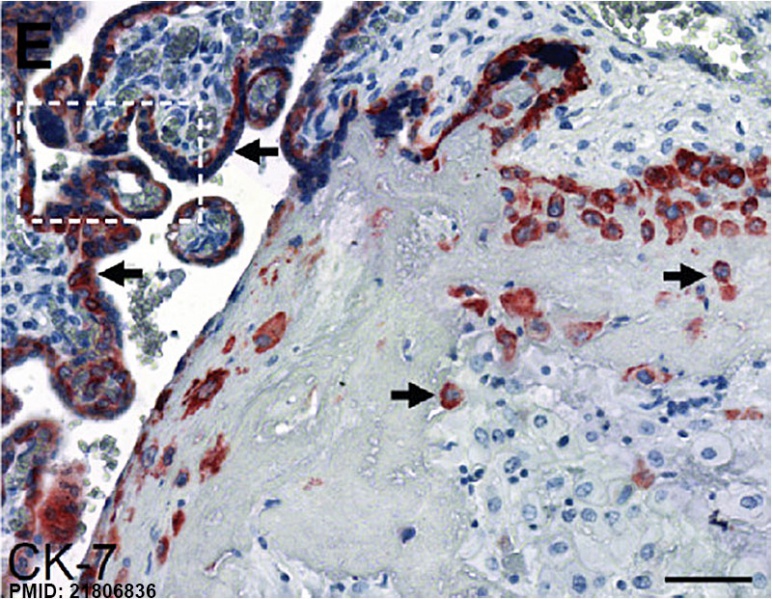 File:Human placenta cytokeratin 7 expression 01.jpg