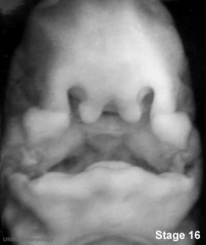 Human Embryo clefting. (Week 6, GA week 8, Stage 16, ventral view)
