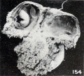 Fig. 154. Opened chorionic vesicle of 1840b and placcntal area of 1840a. X0.66.