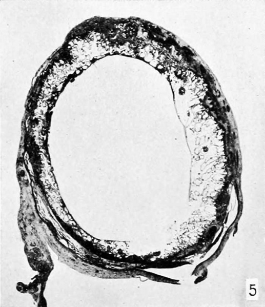 File:Meyer1920 fig05.jpg