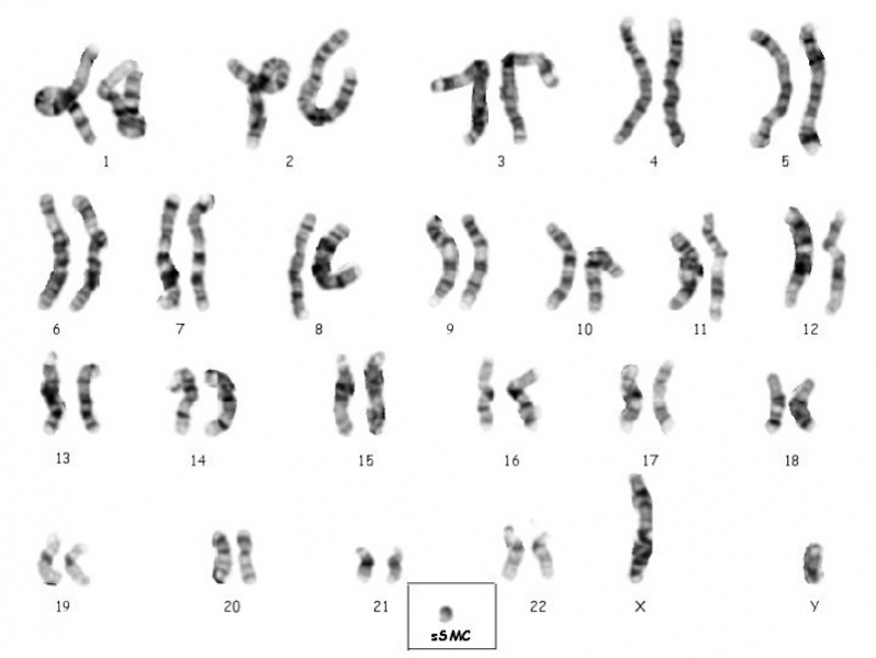File:Small supernumerary marker chromosome 16.jpg