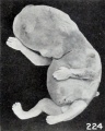 Fig. 224. An older, macerated fetus, with extremities extended instead of folded. No. 1462. X0.77.