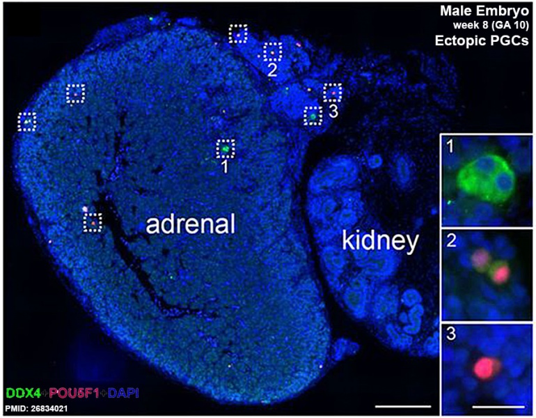 File:Fetal adrenal ectopic germ cells 03.jpg