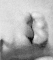 Fig. 18. Embryo No. 475 15 mm