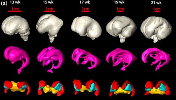 Brain ventricles and ganglia development 01.jpg