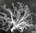 Fig. 273. Villous tree with smooth villi. No. 2253. X6.75.