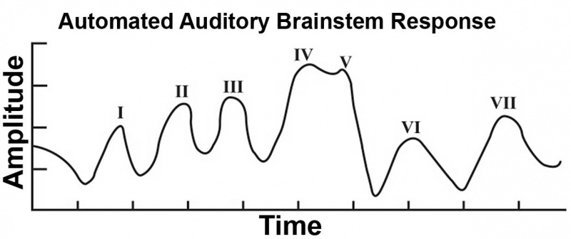 File:Automated Auditory Brainstem Response.jpg