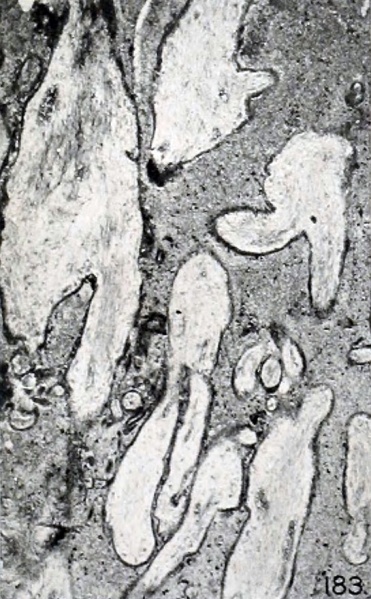 File:Mall Meyer1921 fig183.jpg