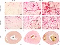 Progressive myofiber replacement by fibrotic and fat tissue in Duchenne Muscular Dystrophy rats