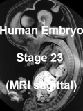 Stage23 MRI S02 icon.jpg