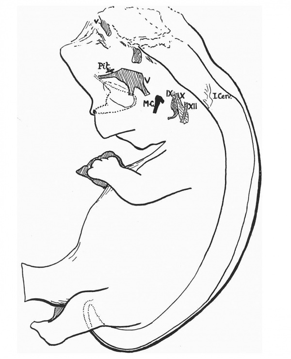 Frazer 1921 Fig 1. reconstruction of anencephalic embryo