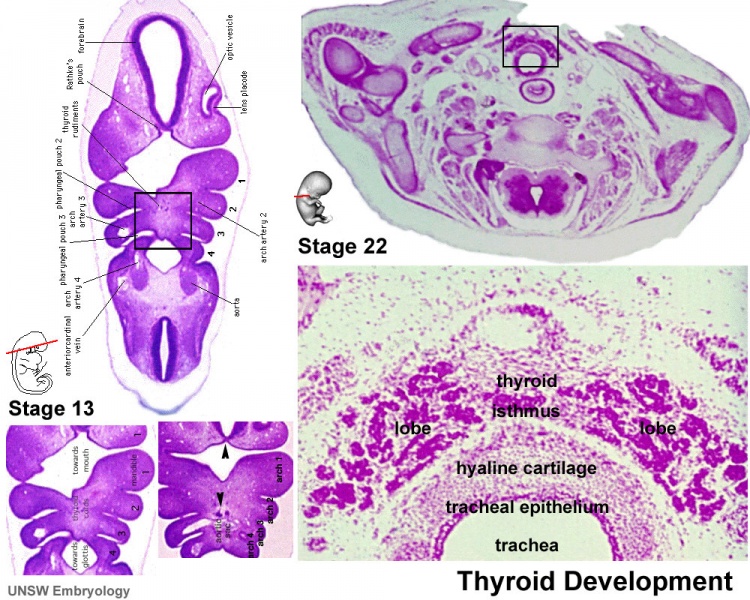 File:Stage13 and 22 thyroid development.jpg