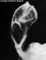 Embryo 5960
