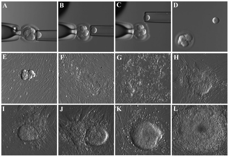 File:Human blastocyst derived stem cells.jpg