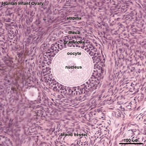 Human infant ovary follicle 01.jpg