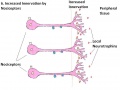 Nociceptor Innervation Increases