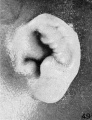 Fig. 49. Embryo No. 1858, 100 mm. (R.)