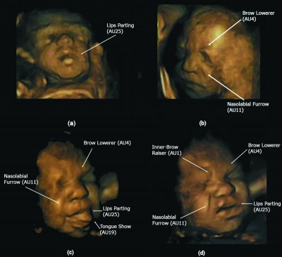 Fetal facial expression 01.jpg