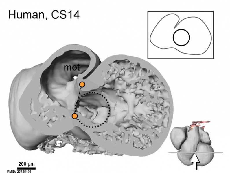 File:Human stage14 heart MRI - ventricular septation.jpg