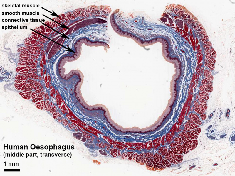 File:Oesophagus histology 08.jpg
