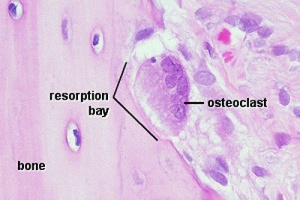 Osteoclast resorptive bay