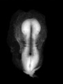 Fig 8 Early stage of neurulation - UNSW image
