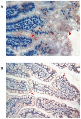 A)Fetal stomach with Tβ4-immunoreactive granules shown by arrow. Arrow head show the Tβ4 granular deposits located in the mucous of the gastric surface. B)Stomach of adult with intense reactivity for Tβ4 (arrow).