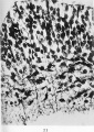 Fig. 11. In this microphotograph the neuroblastic cells are darkcoloured, and in connection with many of these the tapering axis cylinder processes are seen. It will be observed that these processes are growing towards the surface ( i.e the lower part of the figure) through the mesh-work of the myelosponge. Human embryo of four weeks.