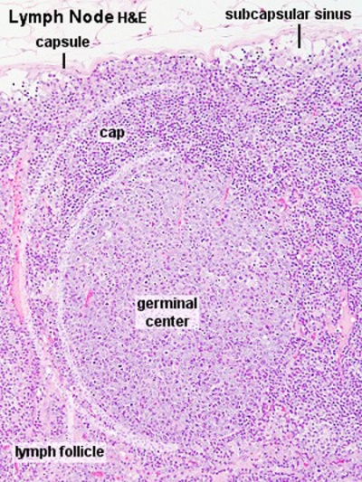 Lymph node histology 03.jpg