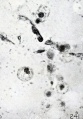 Fig. 241. Pseudo-Hofbauer cells in the ovary. No. 970. X650.