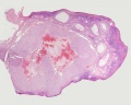 Corpus luteum, theca lutein cells, granulosa lutein cells, Loupe