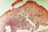 Human- mid-proliferative uterine endometrium.jpg