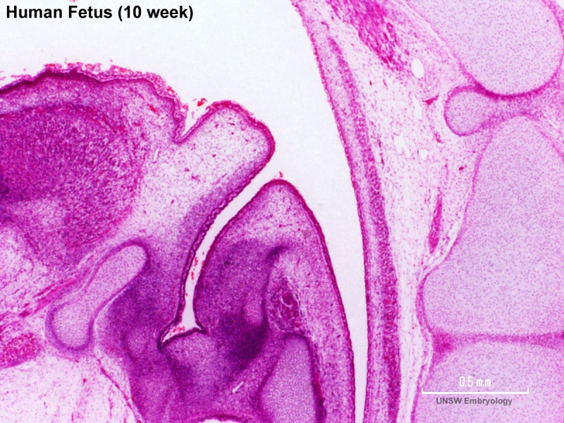 File:Human week 10 fetus 08.jpg