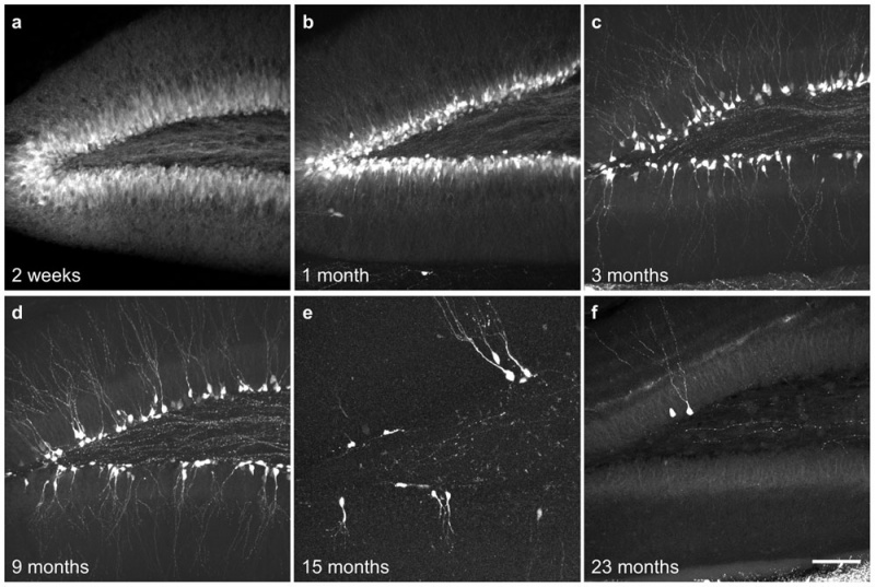File:Mouse- hippocampus dentate granule cells.jpg