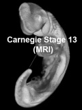 Stage13 MRI 3D03 icon.jpg