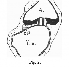 Category:Cloaca - Embryology