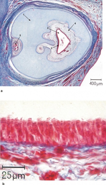 File:Proboscis histology.jpg