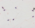Human Spermatozoa