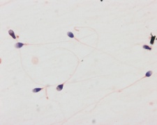 Huma Spermatozoa