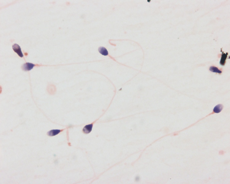 File:Spermatozoa histology 003.jpg