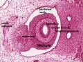 pelvic region - rectum labeled