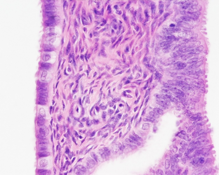 File:Uterine tube histology 04.jpg