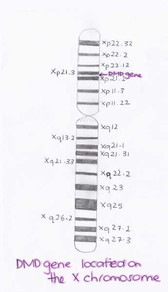 File:X chromosome location of the dystrophin gene.jpg